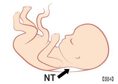 胎児ドックとは 新型出生前診断 Nipt のgenetech株式会社